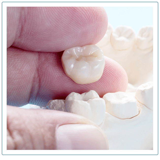 dentist comparing completed crown to the mold