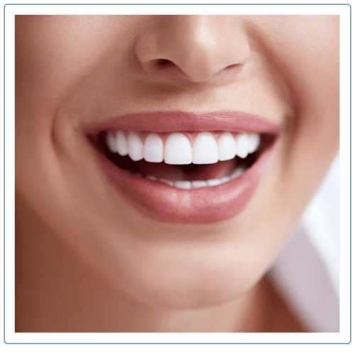 Dental Implants in Birmingham, AL Koch Aesthetic Dentistry