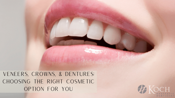 "Veneers, Crowns and Dentures: Choosing the Right Cosmetic Option For You" banner image