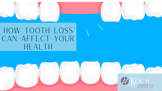 Tooth loss graphic