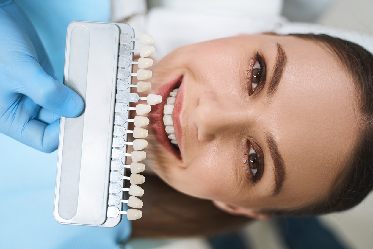 dental aesthetic services