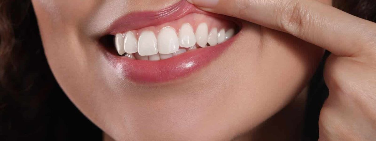 Young woman showing healthy gums, a result of her good oral health