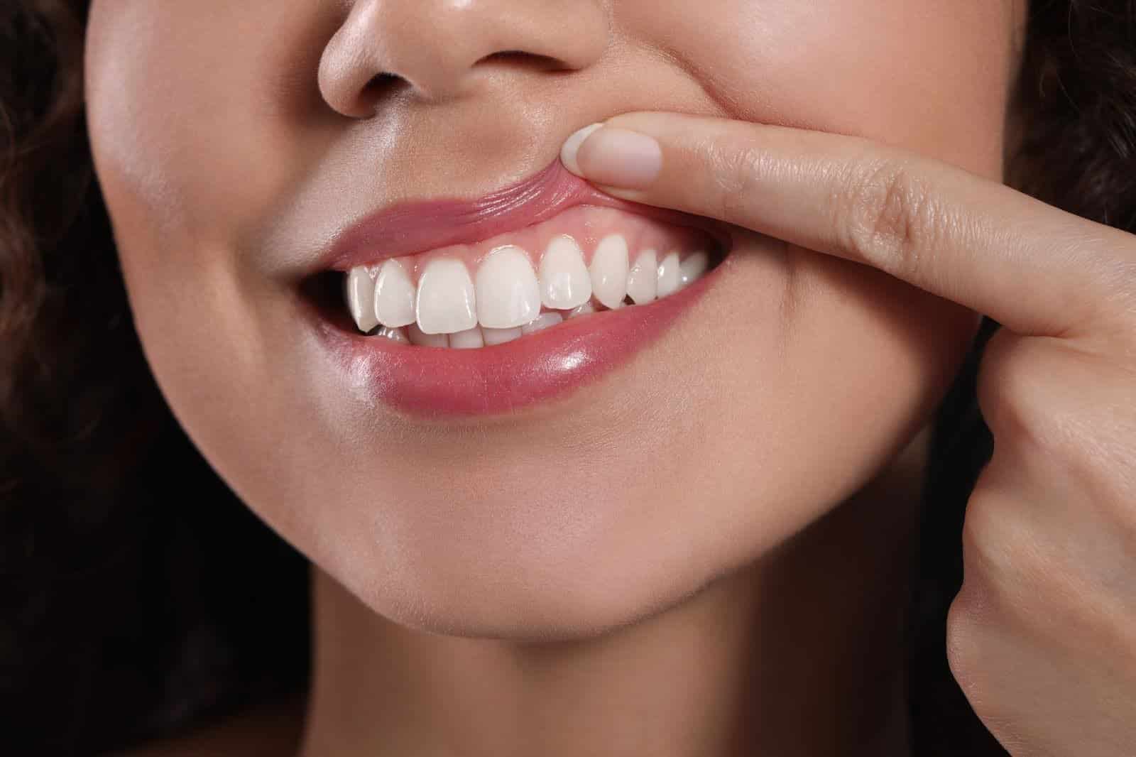 Young woman showing healthy gums, a result of her good oral health
