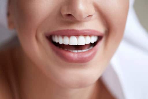 Healthy white smile close up from teeth whitening