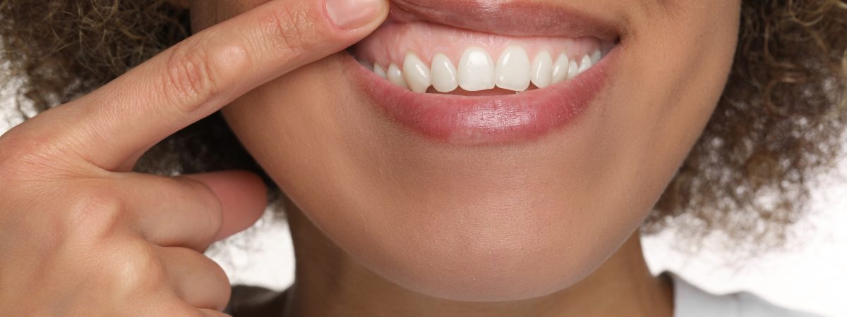 Close-up of a woman’s gummy smile.
