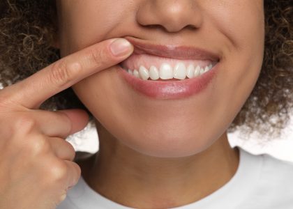 Close-up of a woman’s gummy smile.