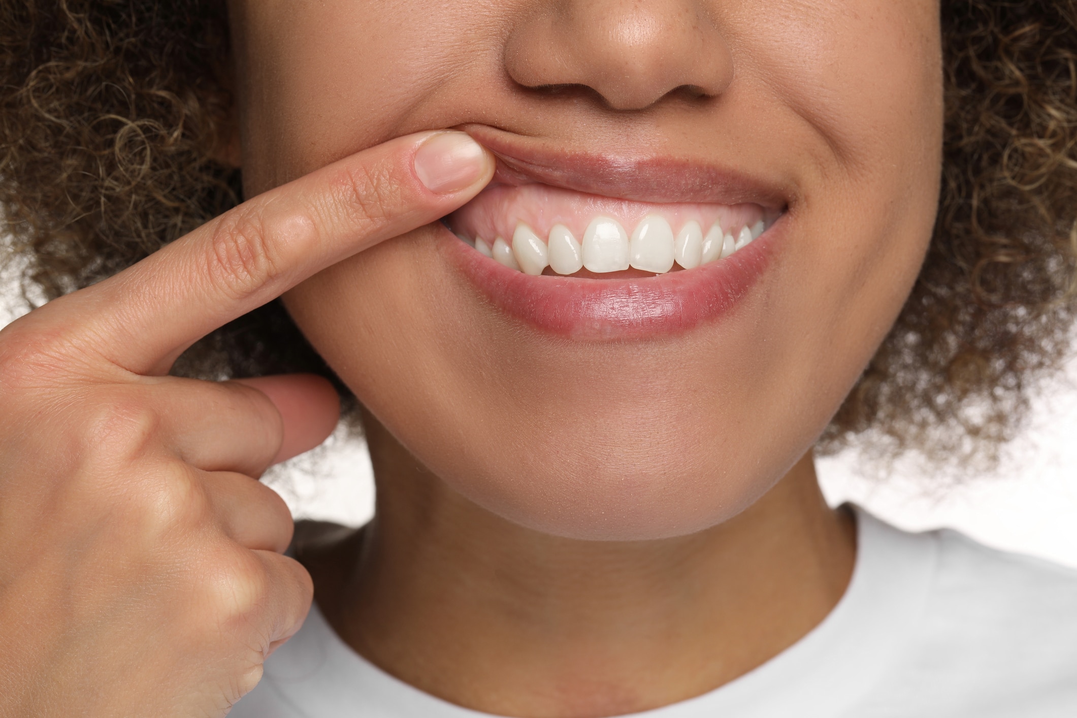 Close-up of a woman’s gummy smile.