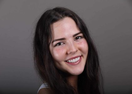 Real photo of a Koch Aesthetic Dentistry patient with veneers