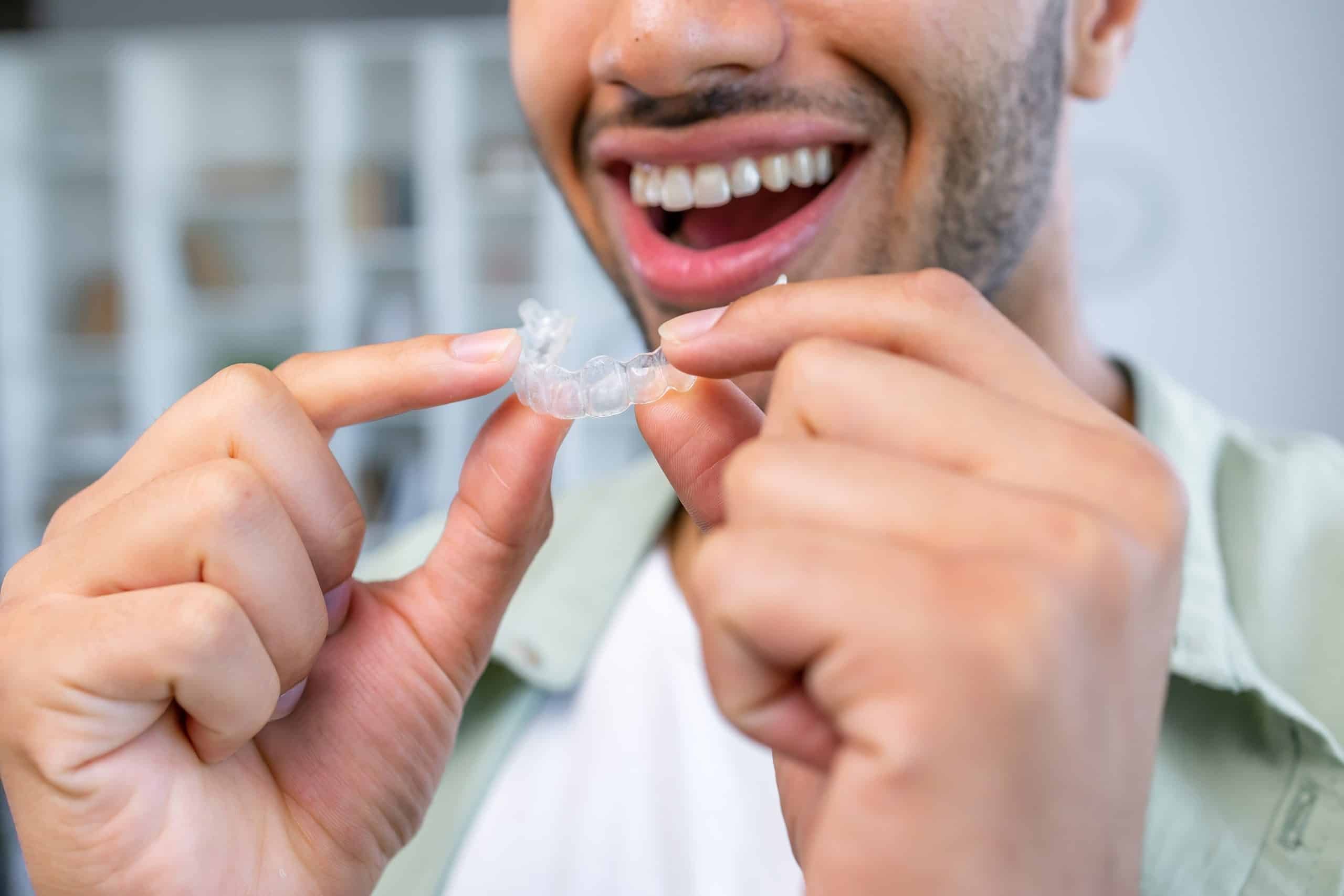 Close-up of a man's hand placing in Invisalign clear aligners
